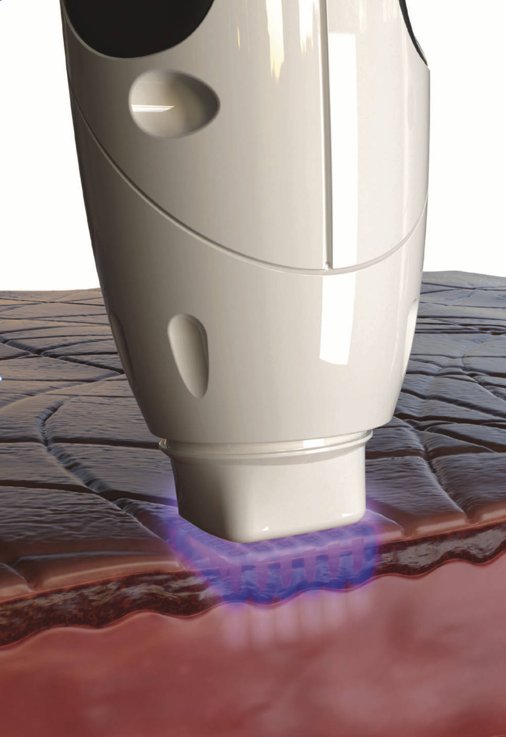 Pryamid Facelift Belfast